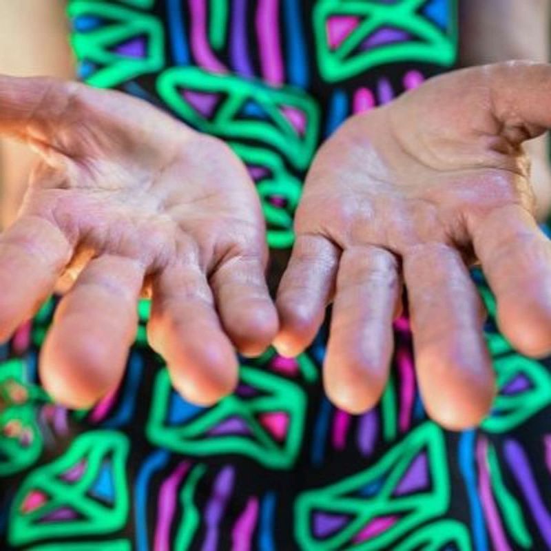 Estrogen Inflammation: Understanding How Hormones Affect Chronic Inflammation During Menopause